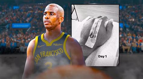 What Chris Paul’s hand surgery means for the Warriors